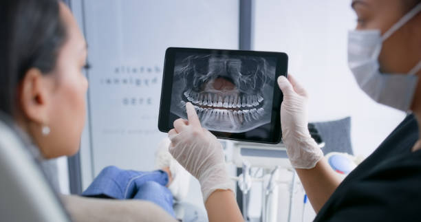 Licensed Tooth Extraction service in Hall County County, GA - Smile Center Dentistry
